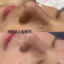청주 피부관리, 청주 윤곽관리, 청주 신부관리, 청주 에그살롱드 스파 솔직 후기