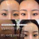 논현동 자연눈썹 잘하는 곳 무통 페더링눈썹 컨설팅 PCL 피씨엘코리아