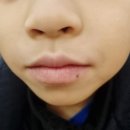 나자로약국 네이버블로그