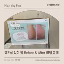네일매끈 | 평택네일샵 유네일 발 각질케어 후기 굳은살 심한 발도 매끈하게 관리 성공✨