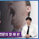 하품이 계속 난다면 뇌졸중!? 하품을 하는 이유 (뇌졸중 전조증상, 하품이 나는 이유) 이미지