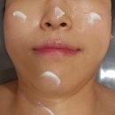 애띠 | 영통피부관리 윤곽관리 애띠애 얼굴소멸관리 얼굴리프팅업 효과본 후기