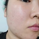 각질 부자 피부가 써본 제로셋 그린티 필링 투 폼 클렌저