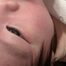 배꼽달래기 호떡순 | 졸업 🐣ㅣbcg 피내용 접종 &amp; 1차 영유아검진 | 자연단유 후기 | DIY 탯줄도장 | 엄마 일상(피부과/다이어트)