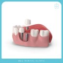 풍무올치과의원 이미지