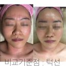청아한에스떼