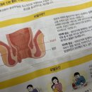 치질 연고 함께 써주니 효과 좋아요