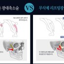 페이스라인성형외과의원 이미지