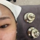 율림교로 | 마산 피부관리 “뷰티스테이” 여드름 관리 후기