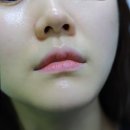 스킨라인미