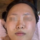 신도림 라멘떼에서 VIP 앰플관리 받아본 솔직후기
