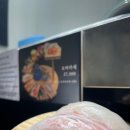 아라초밥 이미지