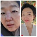 인셀덤스타일 | 인셀덤 화장품 써봤는데… 진짜 대박이었어요 (솔직 사용 후기)