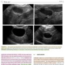 고양이들에서 초음파 상 GB sludge의 prevalence 및 관련된 abnormalities 이미지