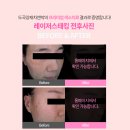 차앤박피부과의원 이미지