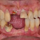 대신치과기공소 이미지