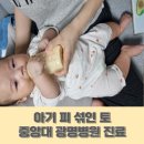 아기 피 섞인 토 - 식겁하고 대학 병원까지 다녀온 이야기