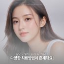 리즈모의원 | 탈모치료 어떤 방법이 있을까요? 대전시청 탈모병원