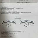 남안경원 네이버블로그