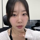 비너스 | 비너스코 6줄 후기 (당일~다음날 붓기, 멍, 통증, 일상생활 가능 여부)