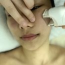 신사역 에스테틱 추천 l 연예인 피부관리 엘피지오신사점