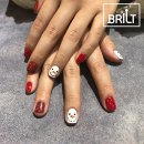 브릴트 | 브릴트 @12월의 아트 실제 시술 사진