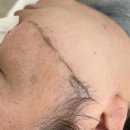 더스킨뷰티샵 | 울산 달동 피부관리 에일린뷰티샵 스킨플래닝 물방울리프팅 후기