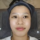 아하제이 | [W10] 웨딩피부관리│송파 문정 피부압출관리 맛집 "제이리움스킨 문정점" (찐관리 후기)