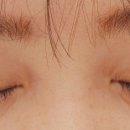 빛날-아이(eye)