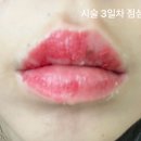 신한제이 | 청주 입술문신 이츠제이 내돈내산 협찬 광고 아님 받고 싶음 상세한 후기