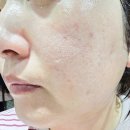 씨유진주평거우방점 | 진주 에스테틱 추천 평거동 소솜에스테틱 아가모공샷 후기