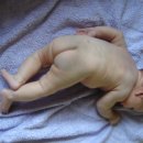 몽고반점 이미지