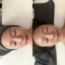 파워 스트레칭 | 창원 에스테틱 피부관리 끌리메 끌링 작은얼굴 관리 효과 후기