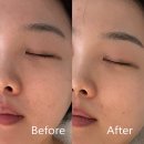노메부띠크 | 부산대 에스테틱 노메부띠크 스킨플래닝 물광피부 후기