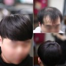 20대 남자가발 추천 잠실 인모 머릿결 가볍고 편리해서 너무좋다