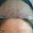 지엘(xiel) 네이버블로그