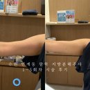 이동한의원 | 수원 인계동 한의원 지방분해주사 1~5회차 팔뚝 신부관리 솔직 후기