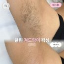 서면왁싱 꼼꼼하게 관리받은 멜로드뷰티 후기