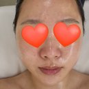 송도피부관리 프롬미 모공청소부터 수분가득 대만족후기