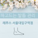 레푸스MS 이미지