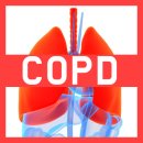 인천 COPD,만성적인 질환 이미지