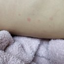 이샘별소아청소년과의원 네이버블로그