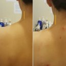휘테라피 이미지