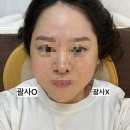 공도한의원 | (안성 공도) 거북목 어깨 통증! "약손 김사부" 마사지