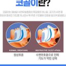 코콜이 원인 / 수면 무호흡증 이미지