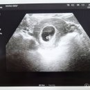모태산부인과의원 네이버블로그