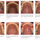 루센트(청) 치과기공소 | 송파구 교정치과 라인드치과 개원 7개월 차, 14년차 교정전문의 이야기