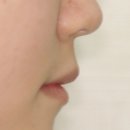 미소가 아름다운 치과교정과치과의원 네이버블로그
