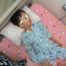 이상열 | 우리연세안과 안검하수 재수술 후기｜6살 아이 자가근막 눈수술 당일