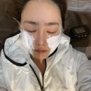 더샤인의원 | 신논현역 피부과 리쥬란 더마샤인 시술효과 통증 솔직후기